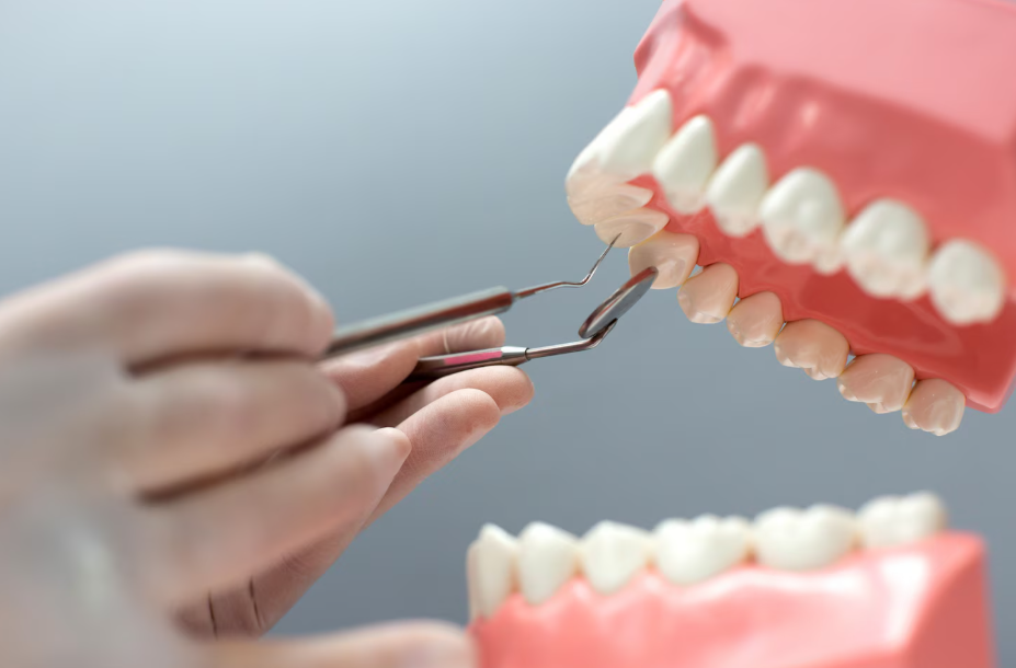 高雄植牙推薦｜牙醫師專業團隊與成功案例分享